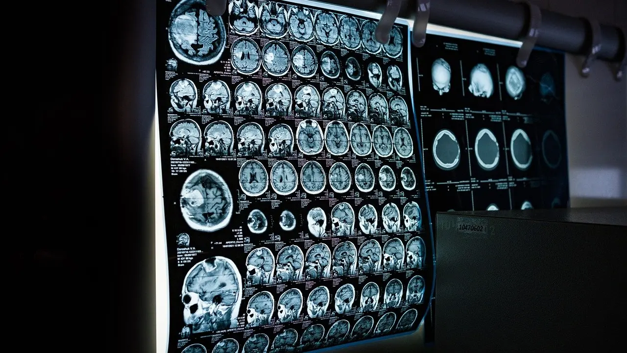 how to support brain health naturally