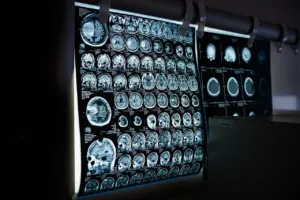 how to support brain health naturally