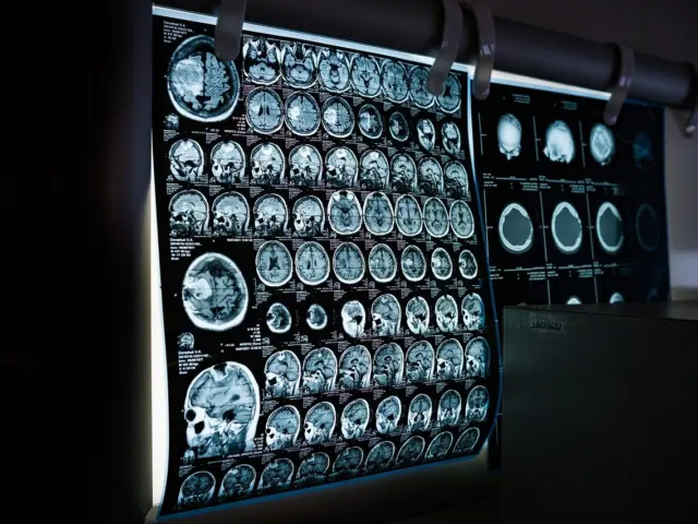 Natural Ways to Support Brain Health
