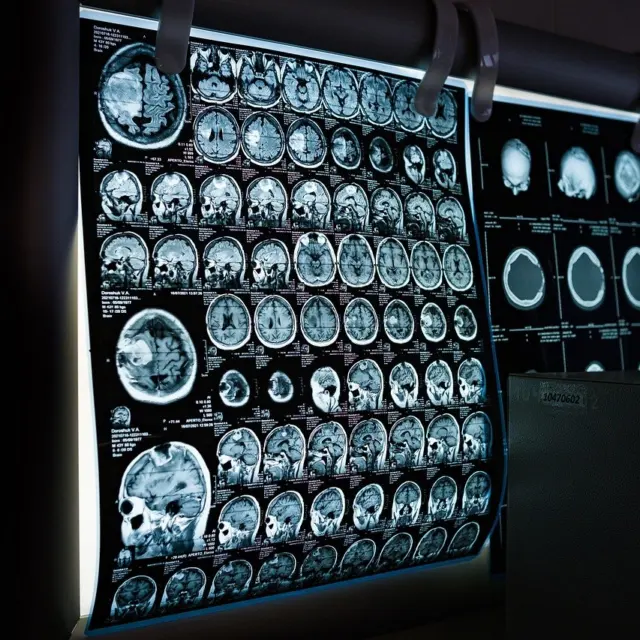 Natural Ways to Support Brain Health